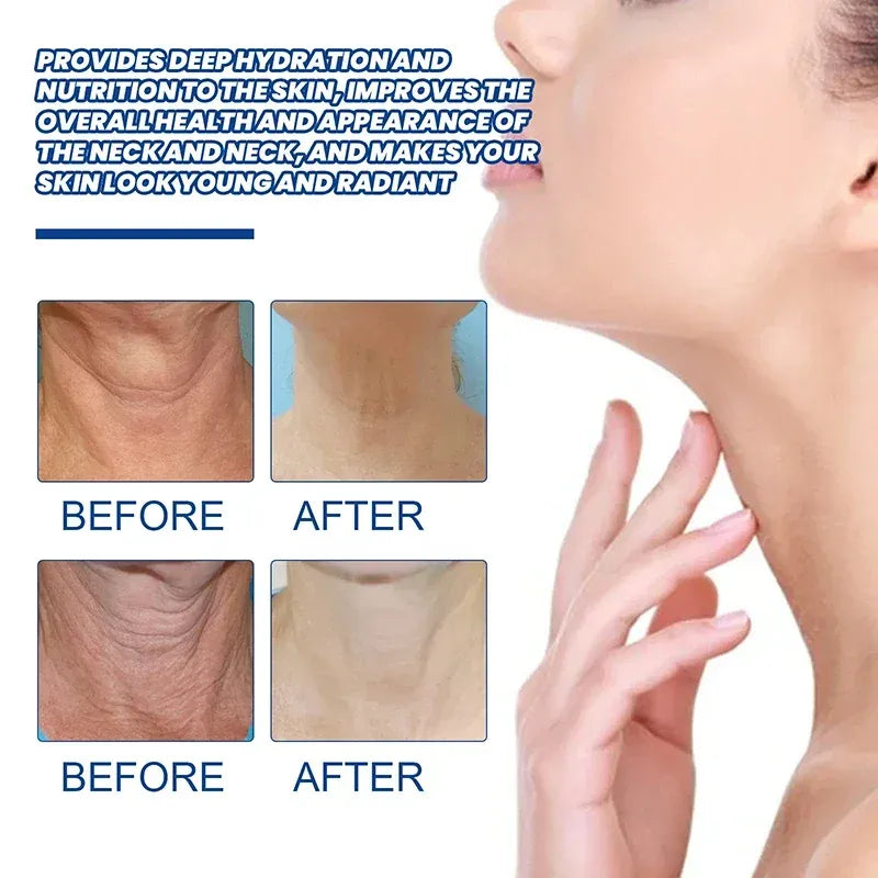 Proteína Neck Lines Moisturizer Cream